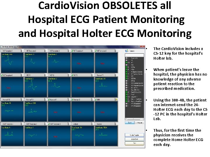 Cardio. Vision OBSOLETES all Hospital ECG Patient Monitoring and Hospital Holter ECG Monitoring •