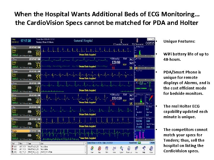 When the Hospital Wants Additional Beds of ECG Monitoring… the Cardio. Vision Specs cannot