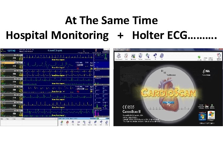 At The Same Time Hospital Monitoring + Holter ECG………. 
