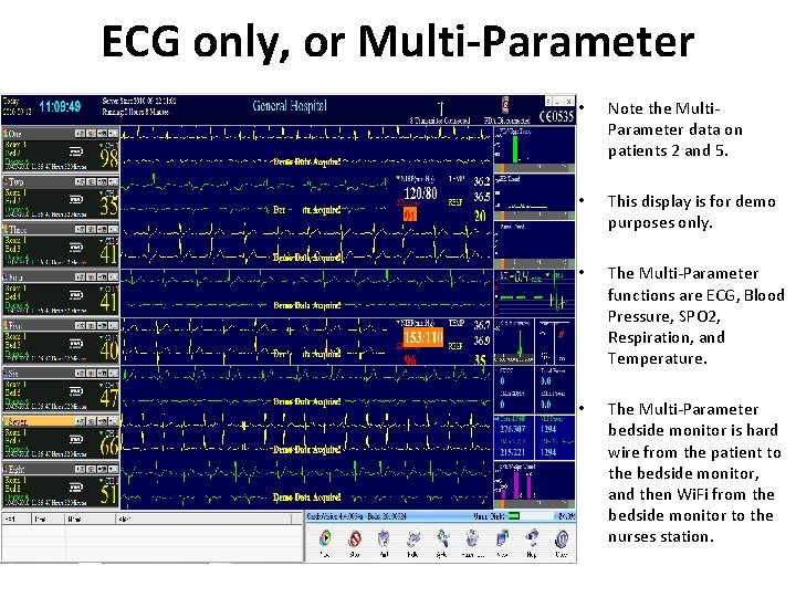 ECG only, or Multi-Parameter • Note the Multi. Parameter data on patients 2 and