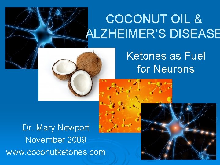 COCONUT OIL & ALZHEIMER’S DISEASE Ketones as Fuel for Neurons Dr. Mary Newport November
