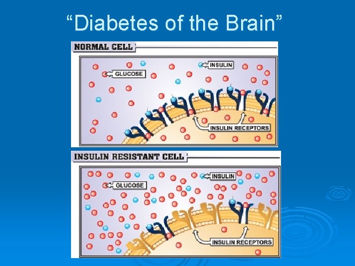 “Diabetes of the Brain” 