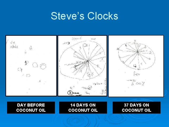 Steve’s Clocks DAY BEFORE COCONUT OIL 14 DAYS ON COCONUT OIL 37 DAYS ON