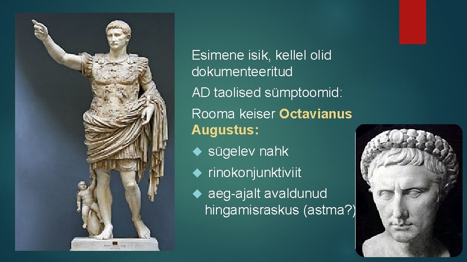 Esimene isik, kellel olid dokumenteeritud AD taolised sümptoomid: Rooma keiser Octavianus Augustus: sügelev nahk