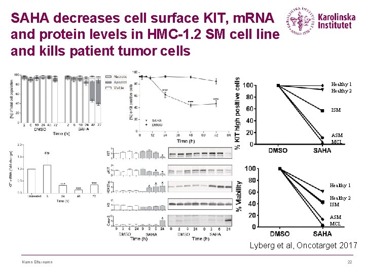 SAHA decreases cell surface KIT, m. RNA and protein levels in HMC-1. 2 SM SAHA decreases cell surface KIT, m. RNA and protein levels in HMC-1. 2 SM