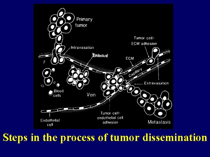 Steps in the process of tumor dissemination 
