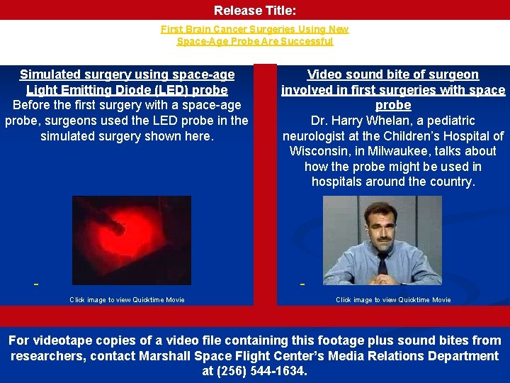 Release Title: First Brain Cancer Surgeries Using New Space-Age Probe Are Successful Simulated surgery