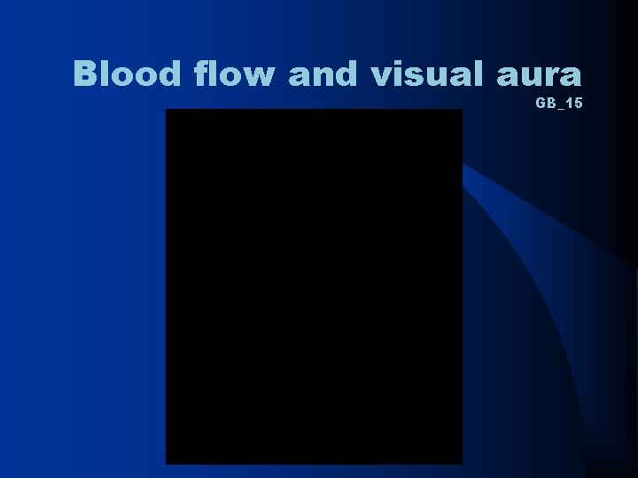 Blood flow and visual aura GB_15 