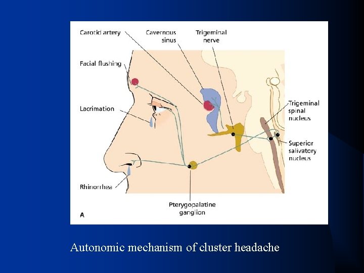 Autonomic mechanism of cluster headache 