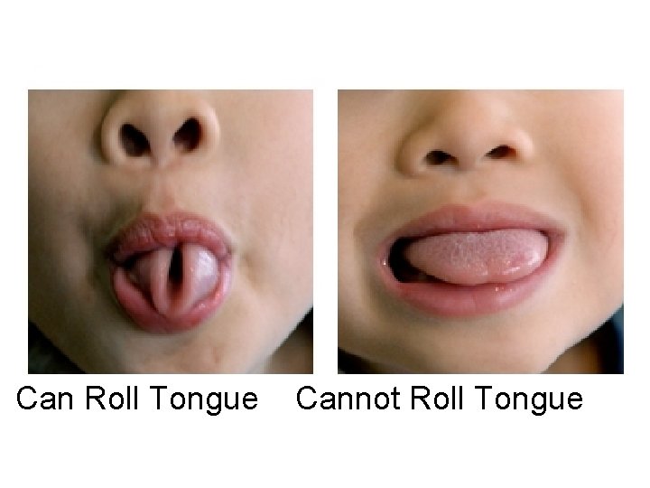 Can Roll Tongue Cannot Roll Tongue 