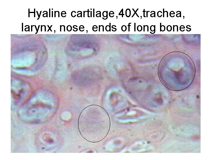 Hyaline cartilage, 40 X, trachea, larynx, nose, ends of long bones 