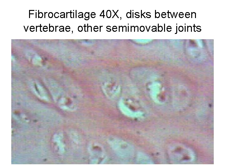 Fibrocartilage 40 X, disks between vertebrae, other semimovable joints 