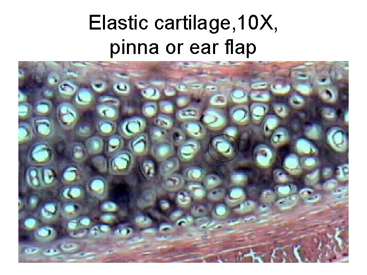 Elastic cartilage, 10 X, pinna or ear flap 