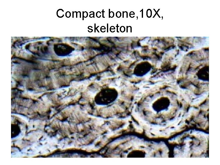 Compact bone, 10 X, skeleton 