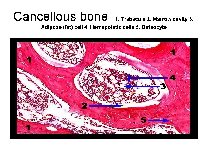 Cancellous bone 1. Trabecula 2. Marrow cavity 3. Adipose (fat) cell 4. Hemopoietic cells