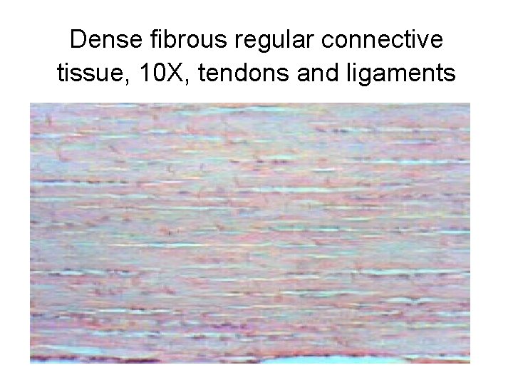 Dense fibrous regular connective tissue, 10 X, tendons and ligaments 