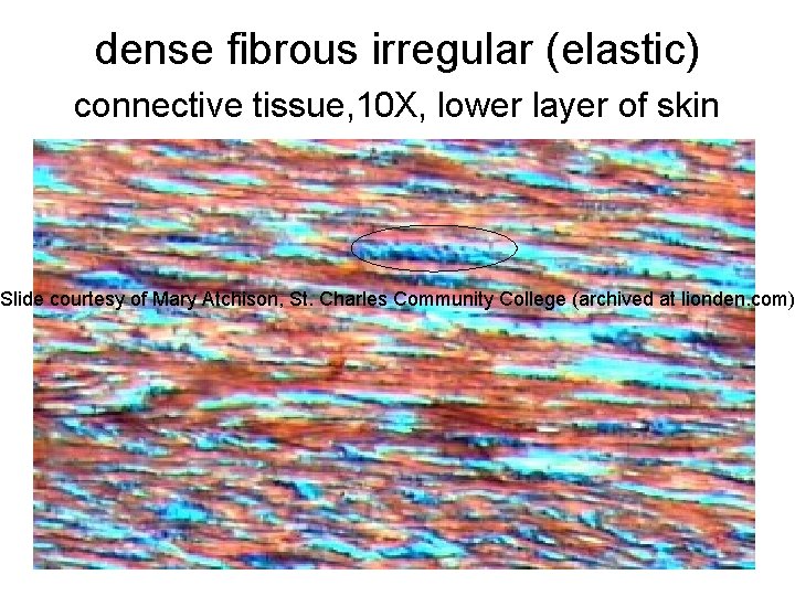dense fibrous irregular (elastic) connective tissue, 10 X, lower layer of skin Slide courtesy