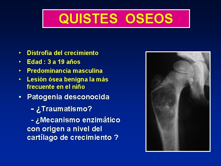 QUISTES OSEOS • • Distrofia del crecimiento Edad : 3 a 19 años Predominancia