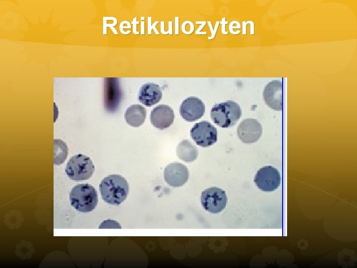Retikulozyten Retikulozyten