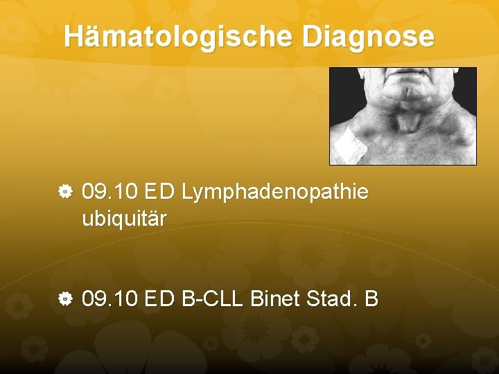 Hämatologische Diagnose 09. 10 ED Lymphadenopathie ubiquitär 09. 10 ED B-CLL Binet Stad. B Hämatologische Diagnose 09. 10 ED Lymphadenopathie ubiquitär 09. 10 ED B-CLL Binet Stad. B
