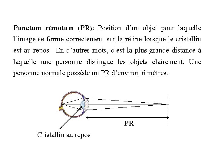 Punctum rémotum (PR): Position d’un objet pour laquelle l’image se forme correctement sur la