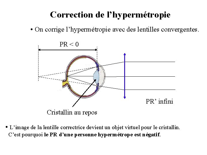 Correction de l’hypermétropie • On corrige l’hypermétropie avec des lentilles convergentes. PR < 0