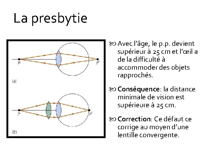 La presbytie Avec l’âge, le p. p. devient supérieur à 25 cm et l’œil