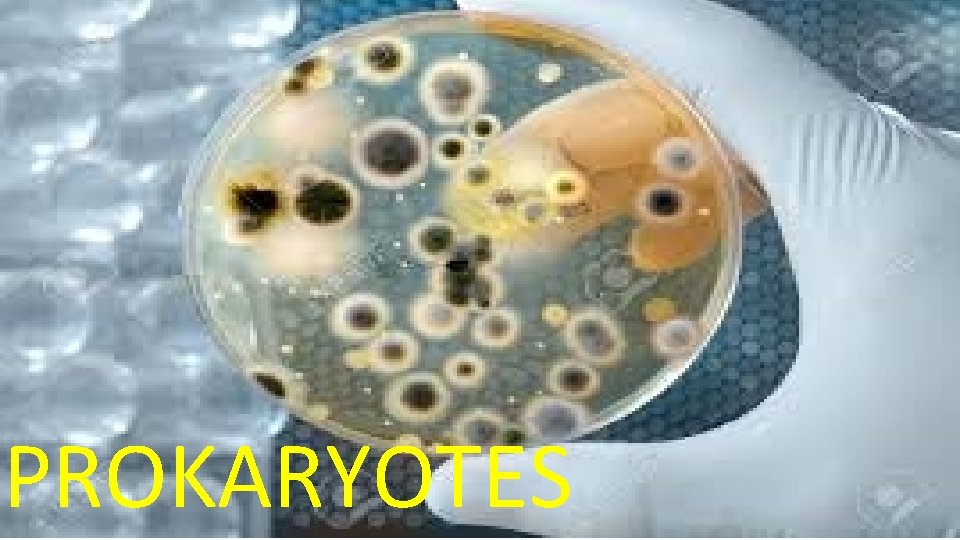 PROKARYOTES 