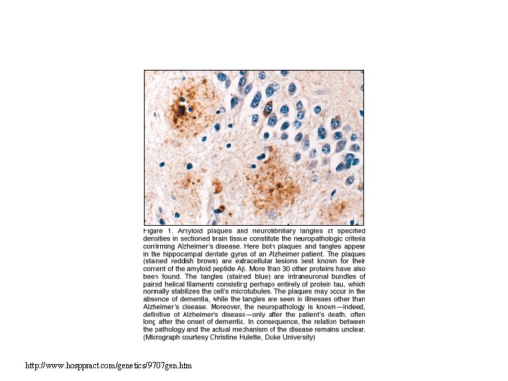 http: //www. hosppract. com/genetics/9707 gen. htm http: //www. hosppract. com/genetics/9707 gen. htm
