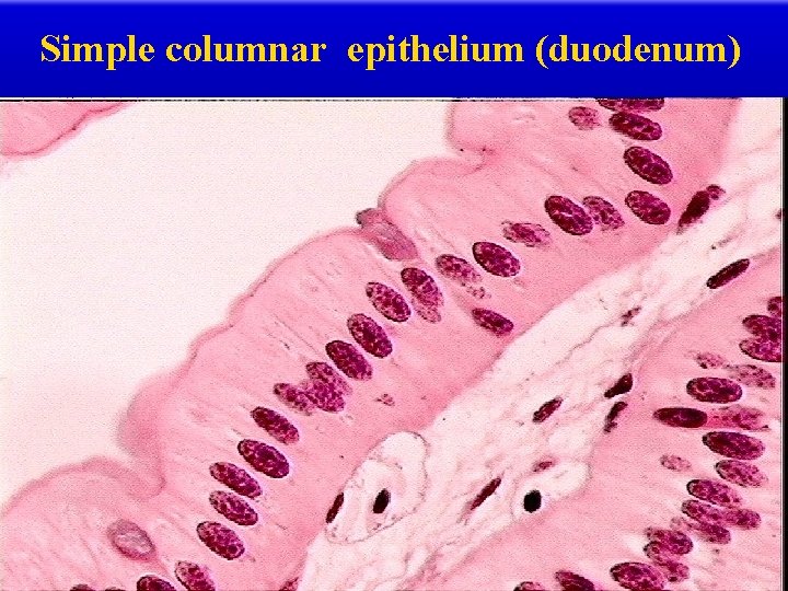 Simple columnar epithelium (duodenum) 