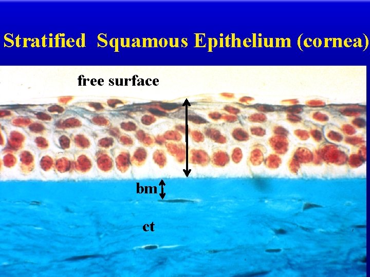 Stratified Squamous Epithelium (cornea) free surface bm ct 