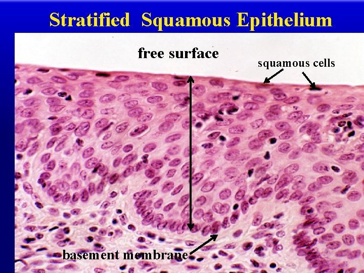 Stratified Squamous Epithelium free surface basement membrane squamous cells 