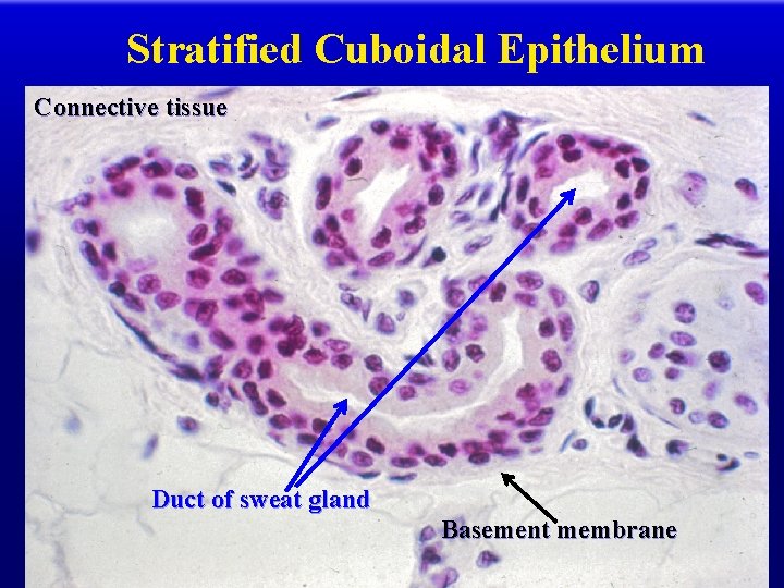 Stratified Cuboidal Epithelium Connective tissue Duct of sweat gland Basement membrane 