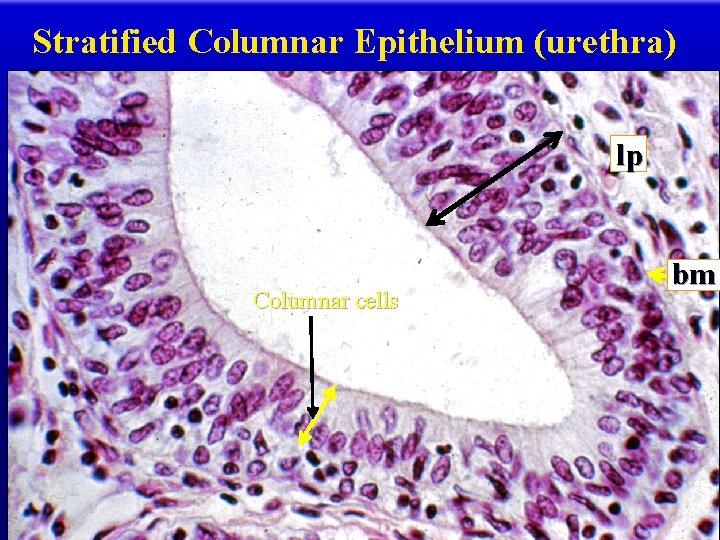 Stratified Columnar Epithelium (urethra) lp Columnar cells bm 