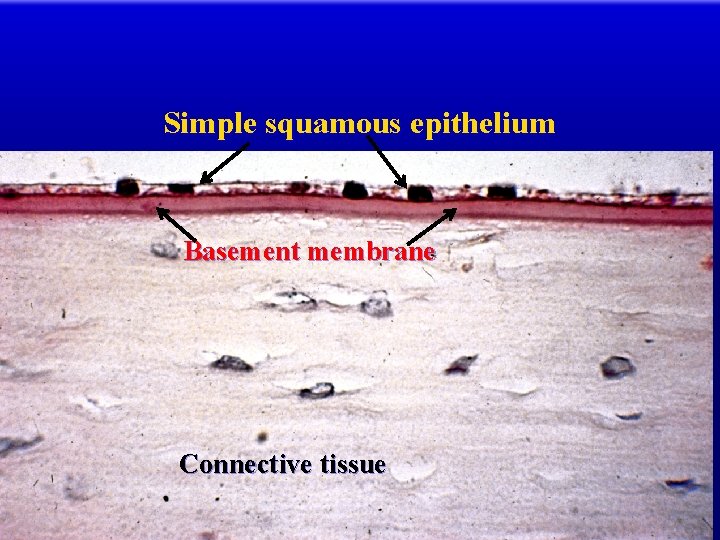 Simple squamous epithelium Basement membrane Connective tissue 