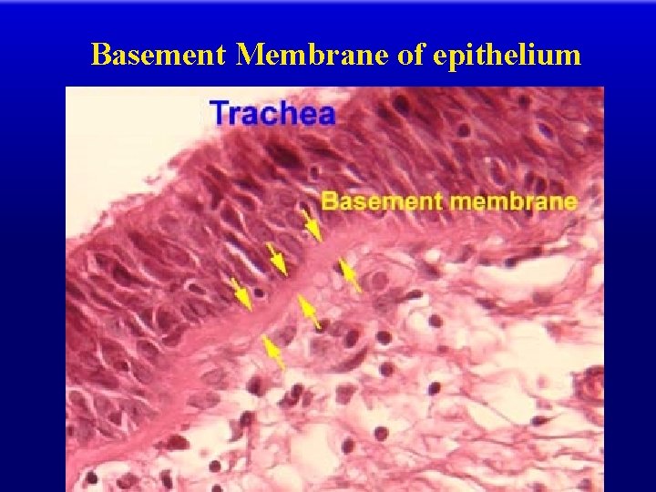 Basement Membrane of epithelium 