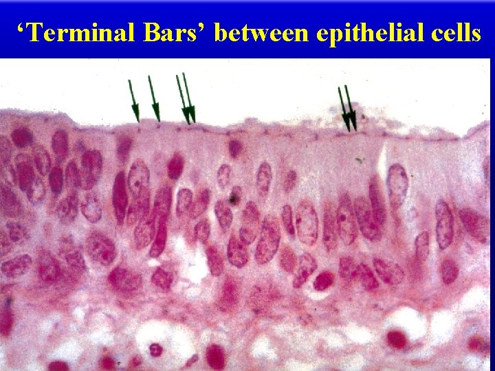 ‘Terminal Bars’ between epithelial cells 