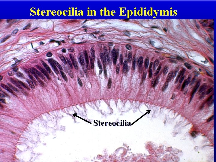 Stereocilia in the Epididymis Stereocilia 