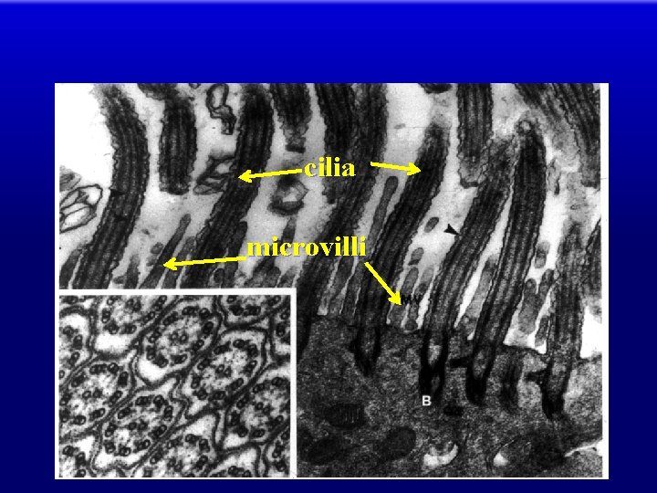 cilia microvilli 