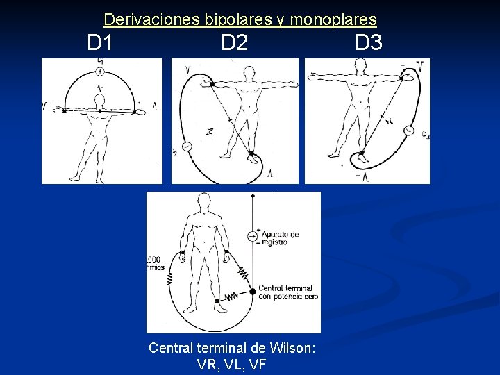 Derivaciones bipolares y monoplares D 1 D 2 Central terminal de Wilson: VR, VL,