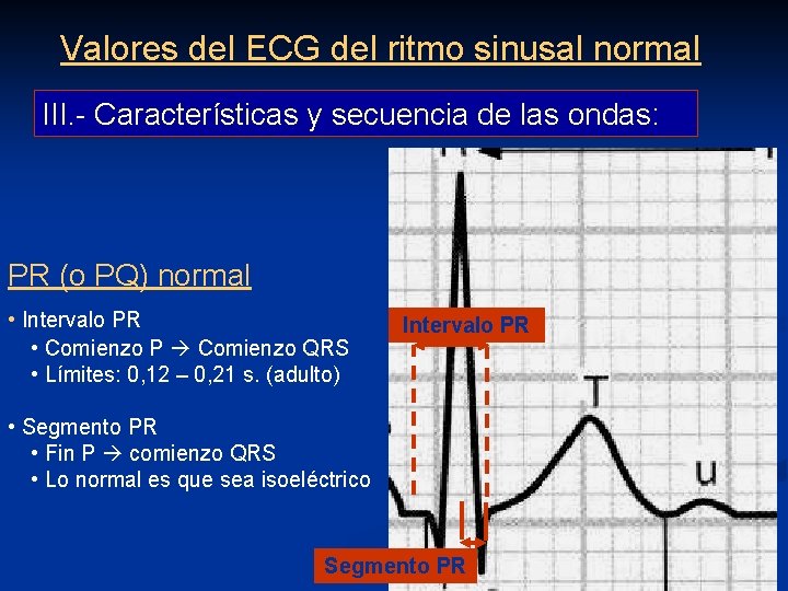 Valores del ECG del ritmo sinusal normal III. - Características y secuencia de las