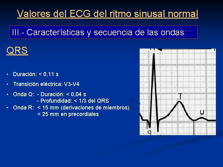 Valores del ECG del ritmo sinusal normal III. - Características y secuencia de las