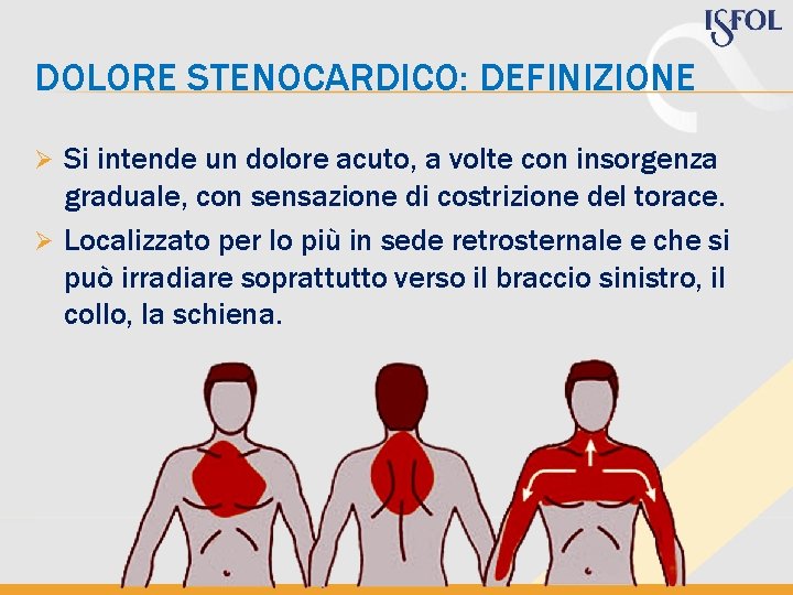 DOLORE STENOCARDICO: DEFINIZIONE Si intende un dolore acuto, a volte con insorgenza graduale, con