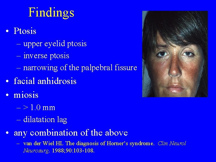 Findings • Ptosis – upper eyelid ptosis – inverse ptosis – narrowing of the