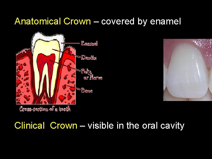 Anatomical Crown – covered by enamel Clinical Crown – visible in the oral cavity