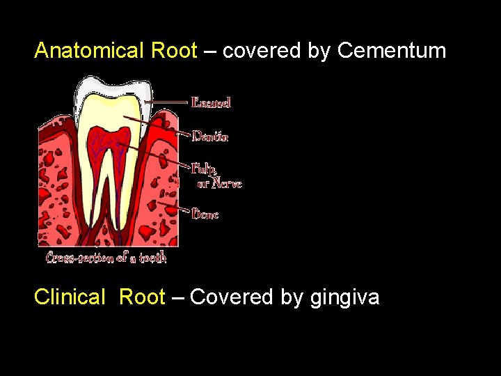 Anatomical Root – covered by Cementum Clinical Root – Covered by gingiva 