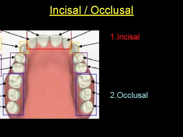 Incisal / Occlusal 1. Incisal 2. Occlusal 