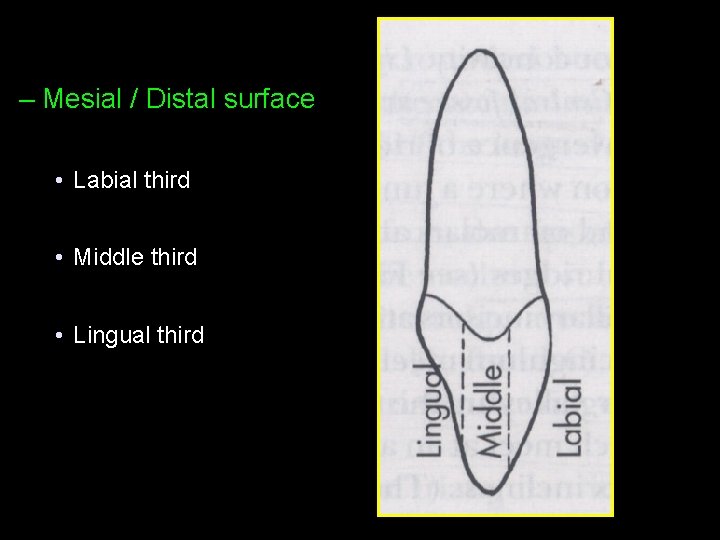 – Mesial / Distal surface • Labial third • Middle third • Lingual third