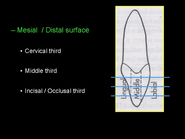 – Mesial / Distal surface • Cervical third • Middle third • Incisal /