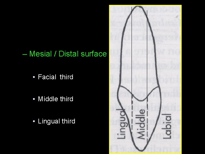 – Mesial / Distal surface • Facial third • Middle third • Lingual third